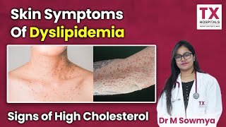 Skin Symptoms of Dyslipidemia Recognizing the Signs of High Cholesterol  DrM Sowmya TX Hospitals [upl. by Anoed166]