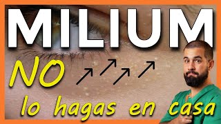 QUISTES de MILIUM o MILIOS Qué son y Cómo quitarlos [upl. by Ekusuy31]