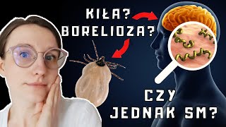 Czy to STWARDNIENIE ROZSIANE Co daje podobne OBJAWY Borelioza kiła Czy mam SM  O choroba [upl. by Rohclem]