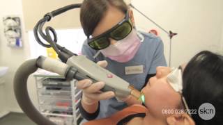 Laser Hair Removal  How does it work [upl. by Abbotsen]