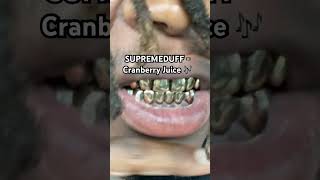 Perm Cut Gold Grillz [upl. by Nylle320]