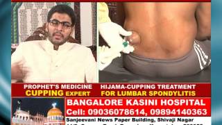 Dr Yasir Arafath Hijama Cupping [upl. by Rushing790]