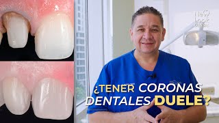 ¿Tener coronas dentales duele Infórmate con el Dr Julián 🦷👨‍⚕️ [upl. by Irok909]