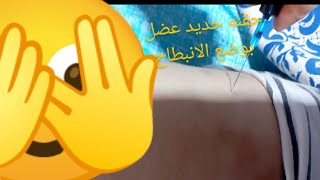 حقنه حديد عضل 💉 في وضع الانبطاح اخدتها مرتين 😱 مكنتش راضيه تمشي 🙄 [upl. by Peh]