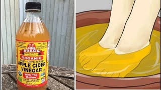 Watch What Happens When You Soak Your Feet In Apple Cider Vinegar [upl. by Oiracam358]