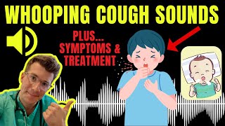 Doctor explains WHOOPING COUGH plus examples of REAL SOUNDS  Symptoms diagnosis treatment amp more [upl. by Magen619]