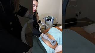 BTL Exilis Elite — Noninvasive Liposuction [upl. by Cathrine366]