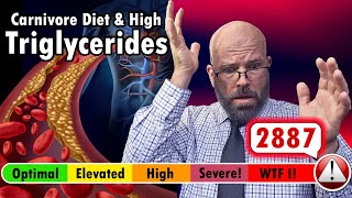 High Triglycerides on a Carnivore or Keto Diet hypertriglyceridemia dislipidemia carnivorediet [upl. by Prentice]