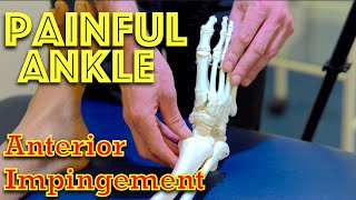 Ankle Pain  Anterior Impingement  Dr Gill [upl. by Ahtael]