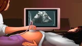 How Ultrasound Works Animation  Ultrasound Scan During Pregnancy Video  USG Medical Imaging [upl. by Marozik98]