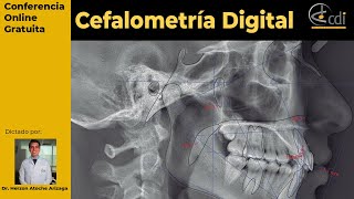 Curso Cefalometría Digital [upl. by Cele]