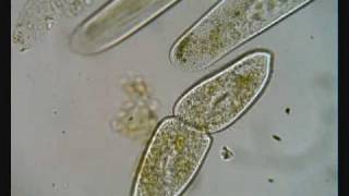 Paramecium Dividing [upl. by Mercado384]