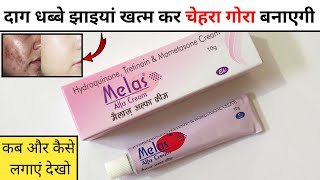 Skin Lite Cream Review  Skin Whitening Cream Use Side Effects In Hindi [upl. by Kciredor737]