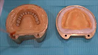 Processing of Complete dentures [upl. by Natascha267]