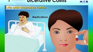 Lybrate  Dt Uc Program What is Ulcerative Colitis [upl. by Neil]