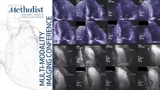 The Role of Stress Echocardiography Ischemia Evaluation amp Beyond M Quinones MD December 14 2021 [upl. by Ylsew525]