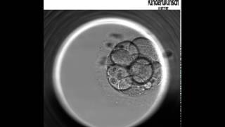 Die Embryo Entwicklung bis zur Blastozyste  Embryoskop [upl. by Suoivatnom]