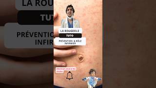 Comprendre et Prévenir la Rougeole  Guide pour les Infirmiers ide tutorial nurse measles tips [upl. by Almallah463]