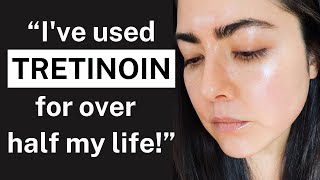 My 22YEAR Tretinoin Experience The Key to Youthful Skin for Over 2 Decades [upl. by Lyrpa]