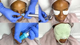 Hydrodermabrasion Facial with Oxygen Infusion Treatment [upl. by Arrek909]