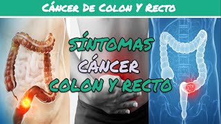 ⚕️🩺 6 SÍNTOMAS de CÁNCER DE COLON Y RECTO Síntomas Diagnóstico y Tratamiento [upl. by Grinnell]