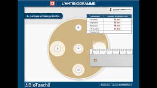 Tout savoir et comprendre sur lantibiogramme → Version courte← [upl. by Venola]