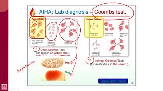 Hematology  2  U1L11  Coombs test [upl. by Kanter]