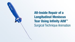 AllInside Repair of a Longitudinal Meniscus Tear Using Infinity AIM™  CONMED Animation [upl. by Mona]