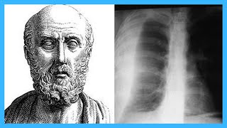 Top 12 Contributions of Hippocrates [upl. by Kyred355]