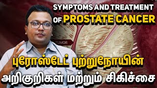 Prostate Cancer Symptoms amp Breakthrough Treatments  Onco Doctor Tamil Dr Dayananda Srinivasan [upl. by Elleimac]