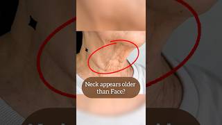 Antigravity Neck exercise to reverse Tech neck Turkey neck shortening neck neck lines🫨 [upl. by Odicalp]