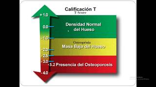 CURBAR 2020  Interpretación de la densitometría ósea en osteoporosis  Luis Fernando Pinto [upl. by Barnaba603]