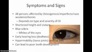 Osteogenesis Imperfecta Lecture [upl. by Eanil]