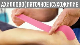 Тейпирование ахиллова сухожилия  Taping guide for Achilles Tendonitis [upl. by Flagler]