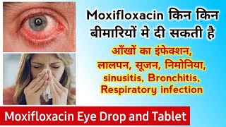 Moxifloxacin eye drops  moxifloxacin eye drops uses hindi  Best Eye drop  use side effects amp Dose [upl. by Latnahs]