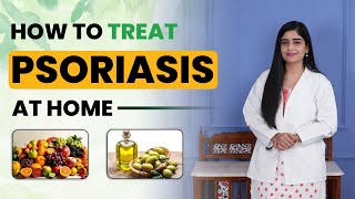 How to Treat Psoriasis at Home  Tips for Fast Psoriasis Recovery  Dr Health [upl. by Nazar927]