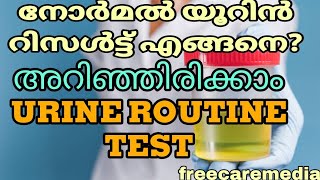 Urine test malayalam  Urine routine testmedicallaboratorytechnician urinetest urine [upl. by Winsor347]