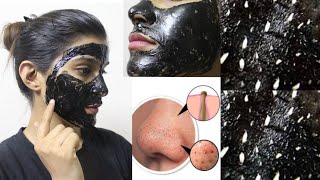 CHARCOAL Peel Off Mask Does It Work हिंदी ReviewSuper Style Tips [upl. by Valley]