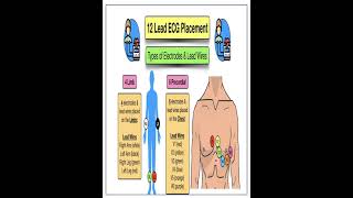 ECG lead placement chest lead and limb leadecg ecg basiclecture youtube SafaMedicalLecture [upl. by Talley]