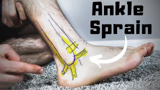 Twisted or Rolled Ankle Sprain Treatment FASTER Home Recovery Time [upl. by Solley335]