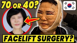 Unbelievable Korean Facelift Before amp After Mommy Makeover  Plastic Surgery in Korea vlog Part2 [upl. by Nereus583]