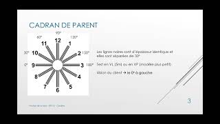 18 Cours Analyse de la Vision  Extériorisation du cadran de Parent œil astigmate  BTS OL [upl. by Martinic]