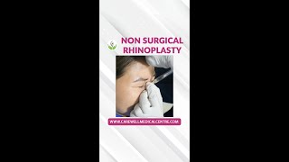 NonSurgical Rhinoplasty How Its Done  Nose Filler How It Works  Nose Job The Process [upl. by Anelrats429]