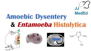 Amebiasis Amoebic Dysentery  Entamoeba histolytica Pathogenesis Signs amp Symptoms Treatment [upl. by Eillehs]