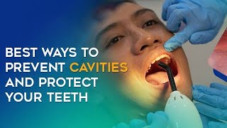 quotYour Teeth’s Worst Enemy How to Beat Cavities for Goodquot dentist caries teeth [upl. by Irvin158]