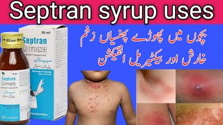 Septran syrup uses in Urduseptran syrupbacterial infection co trimoxazole [upl. by Ayotak]