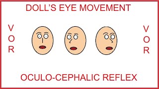 DOLLS EYE MOVEMENT OCULOCEPHALIC REFLEXVESTIBULOOCULAR REFLEX [upl. by Combes]