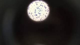 Microorganimos Enterococcus faecium [upl. by Gomer]