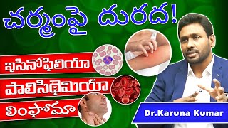 Reasons for Itchy skin in Telugu  Dr Karuna Kumar [upl. by Pomeroy874]