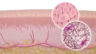 Skin Anatomy and Physiology how skin reacts to wounds [upl. by Eugene]